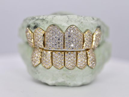 6 on 6 VVS Moissanite Diamond Grillz - Moissanite Bazaar - moissanitebazaar.com