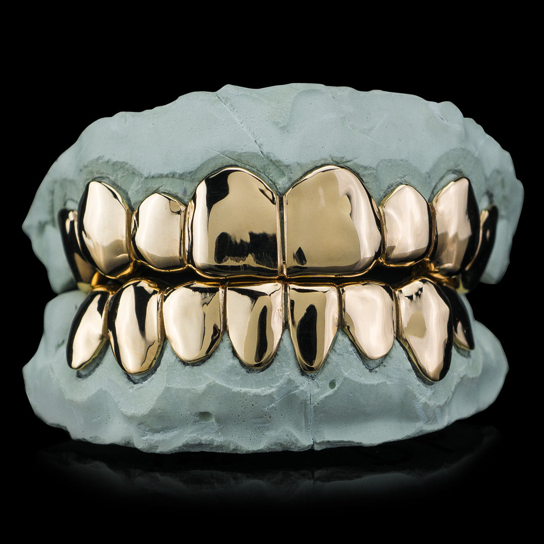 Affordable-Solid-Gold-Deep-Cut-Grillz-Img-Original-Update
