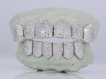 6 on 6 VVS Moissanite Diamond Grillz - Moissanite Bazaar - moissanitebazaar.com