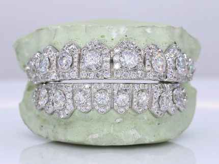 Pointer Stone Center VVS Moissanite Diamond Grillz