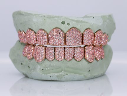 VVS Pink Lab Diamond Grillz