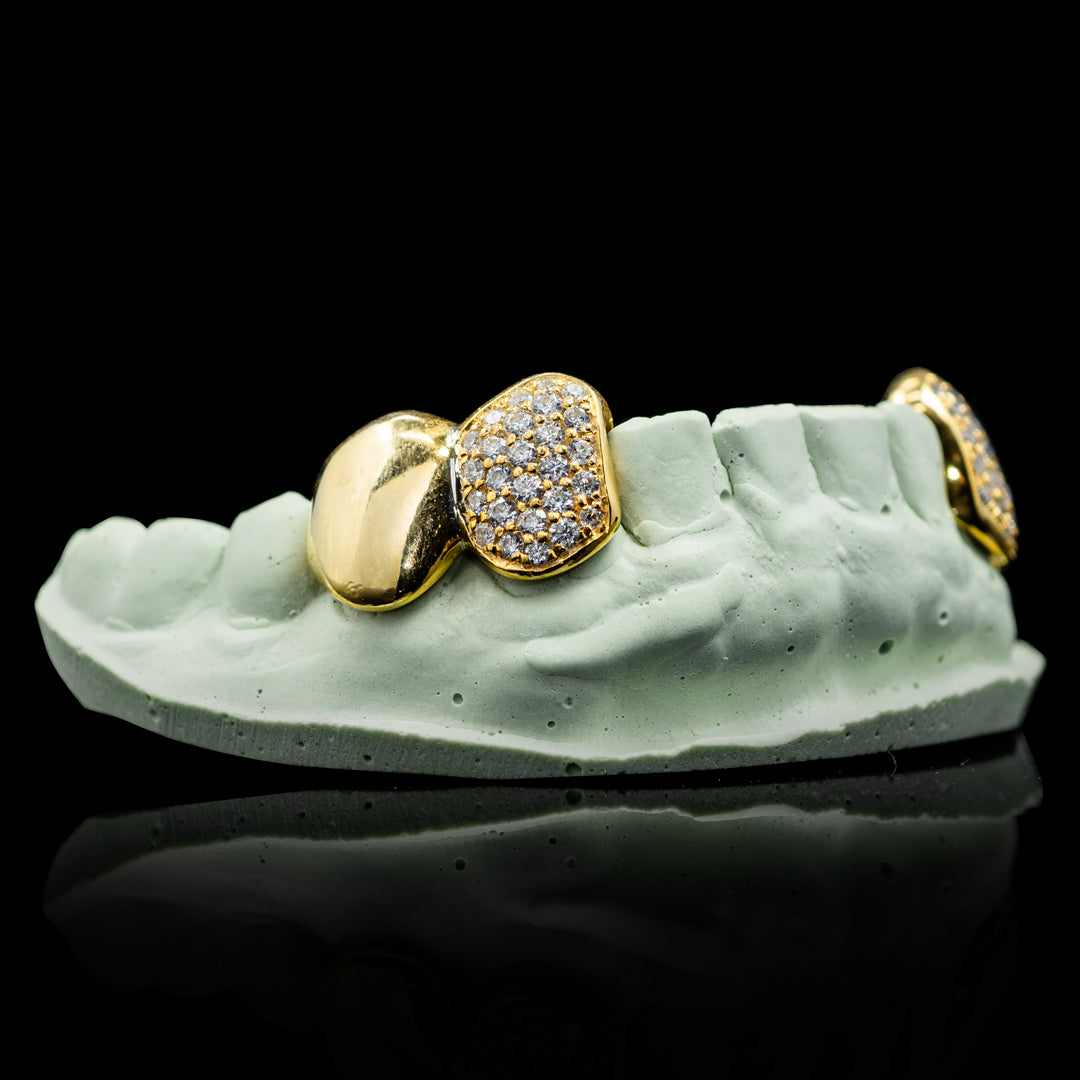 gold-bottom-double-cap-solid-and-iced-out-main-img-1