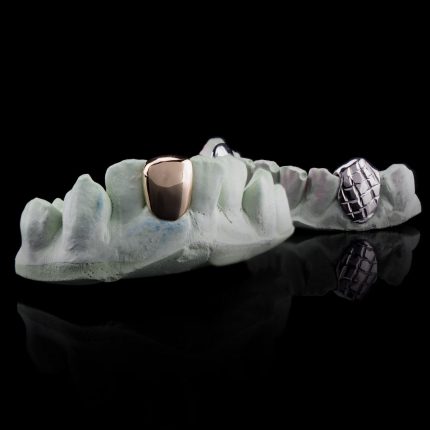 Solid Gold Single Bottom Custom-Made Tooth Grillz with Silver Diamond Cut Single Grill